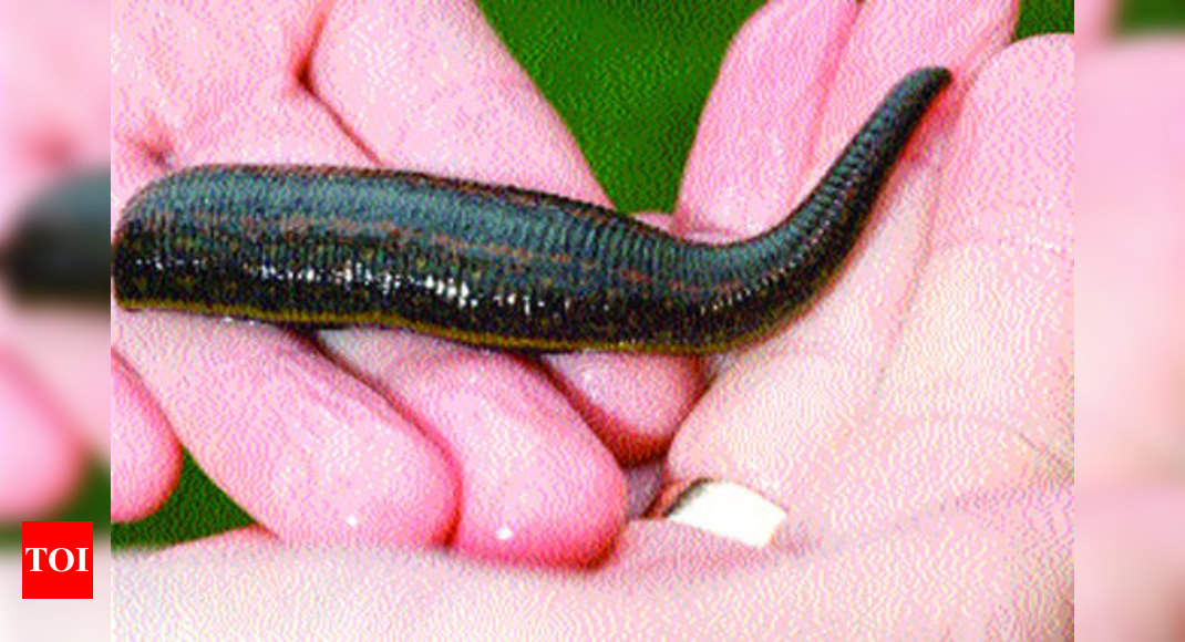 Leech treatment: New for UK, ancient for India - Times of India
