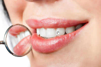 Teeth jewellery the latest trend