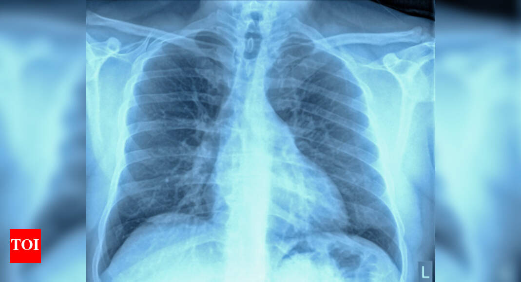 How humans regenerate ribs decoded Times of India