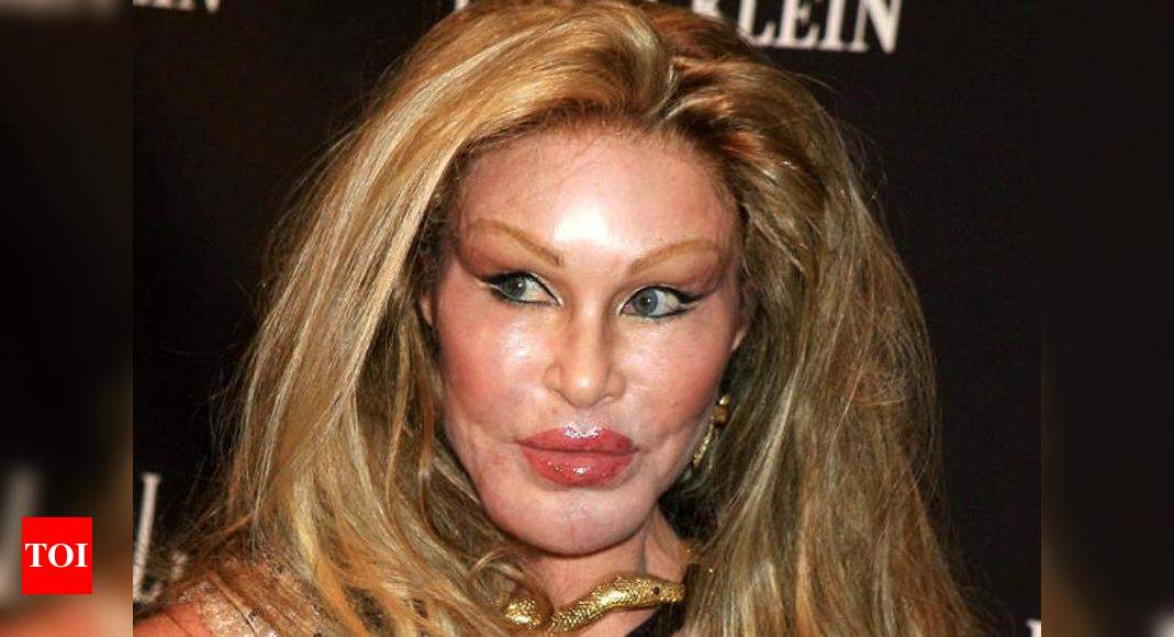 8 Celebrity Plastic Surgery Gone Bad Really Bad Times Of India