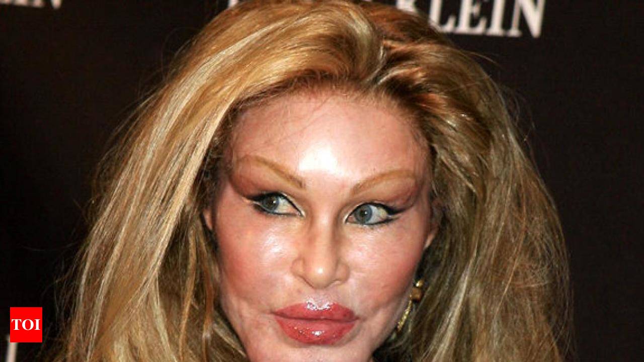 8 Celebrity Plastic Surgery Gone Bad! Really Bad! - Times of India
