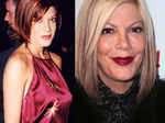 Stars Before & After Cosmetic Surgeries