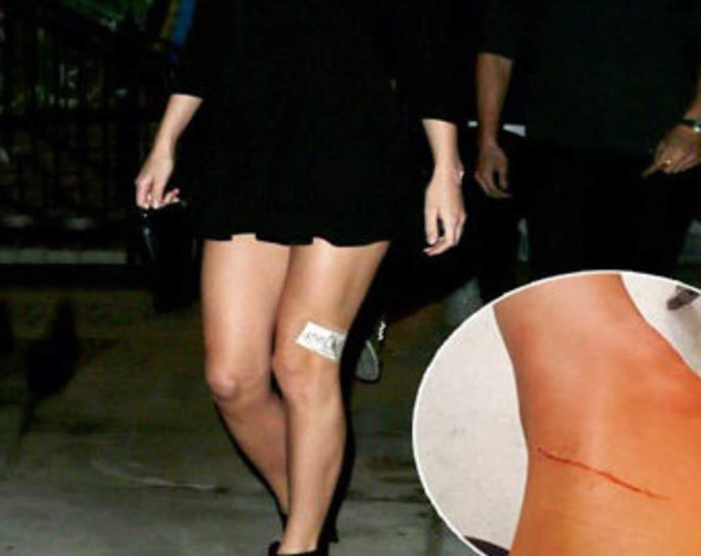 
Taylor Swift's $40 million legs attacked!
