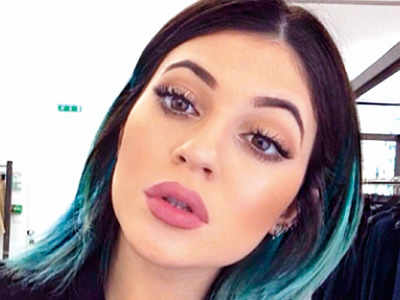 Kylie’s lips bruise the internet