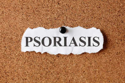 The right way to deal with psoriasis
