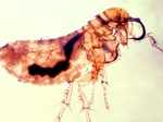 Bubonic Plague comes zoonotic origin. It is transmitted through infected fleas