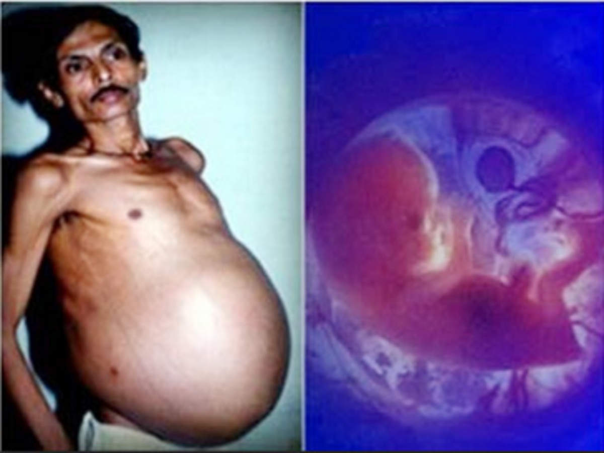 Shocking: Pregnant man gives birth to his brother | News - Times of India  Videos