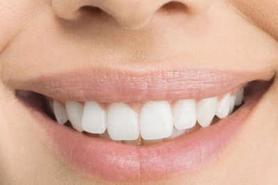 10 tips to keep your teeth healthy
