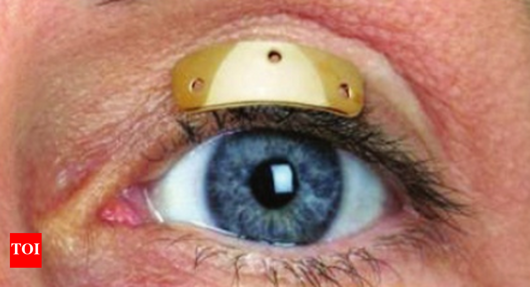 Gold weights on eyelids help cure facial deformity | Bengaluru News ...