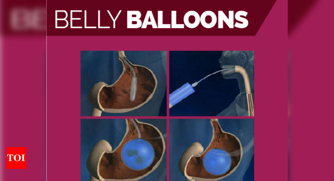 Infographic Belly Balloons India News Times Of India