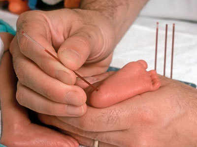 'Newborn screening programme needed'