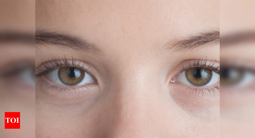 Sunken Eyes, Dark Circles and Heavy Eyelids - The Lime Tree Clinic