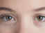 How to repair sunken eyes