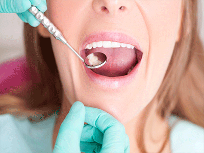 Bioactive glass for long lasting tooth fillings Times of India