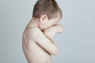 Reason why children develop food allergies explained