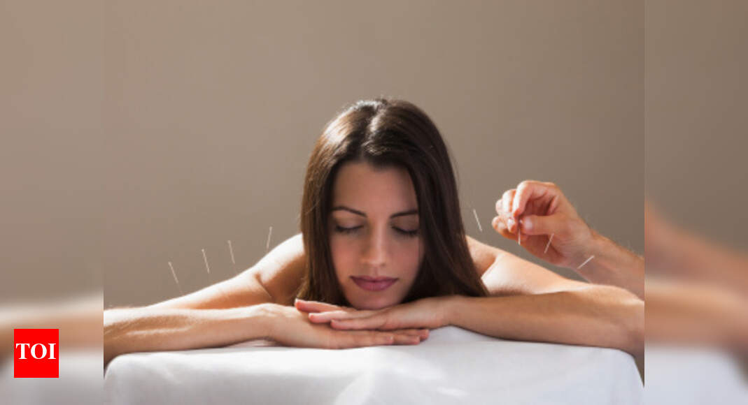 Benefits of acupuncture Times of India