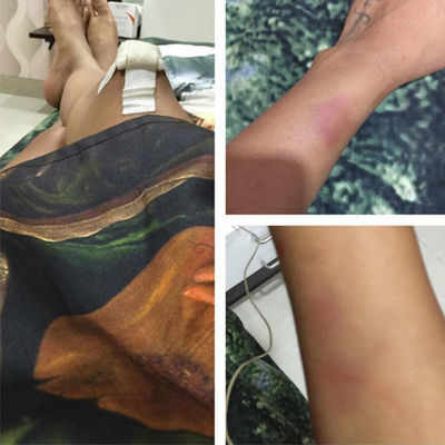 Nia Sharma injured