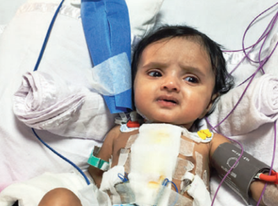 Solapur toddler survives 20 heart attacks over 2 months
