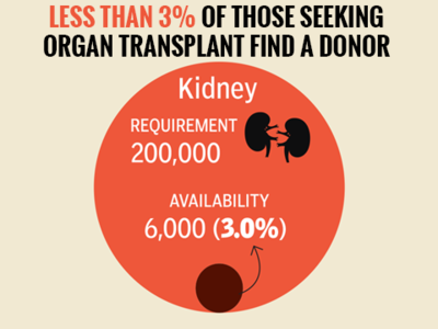 A dearth of organ donors