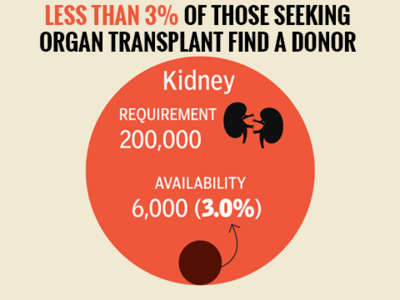 A Dearth Of Organ Donors - Times Of India