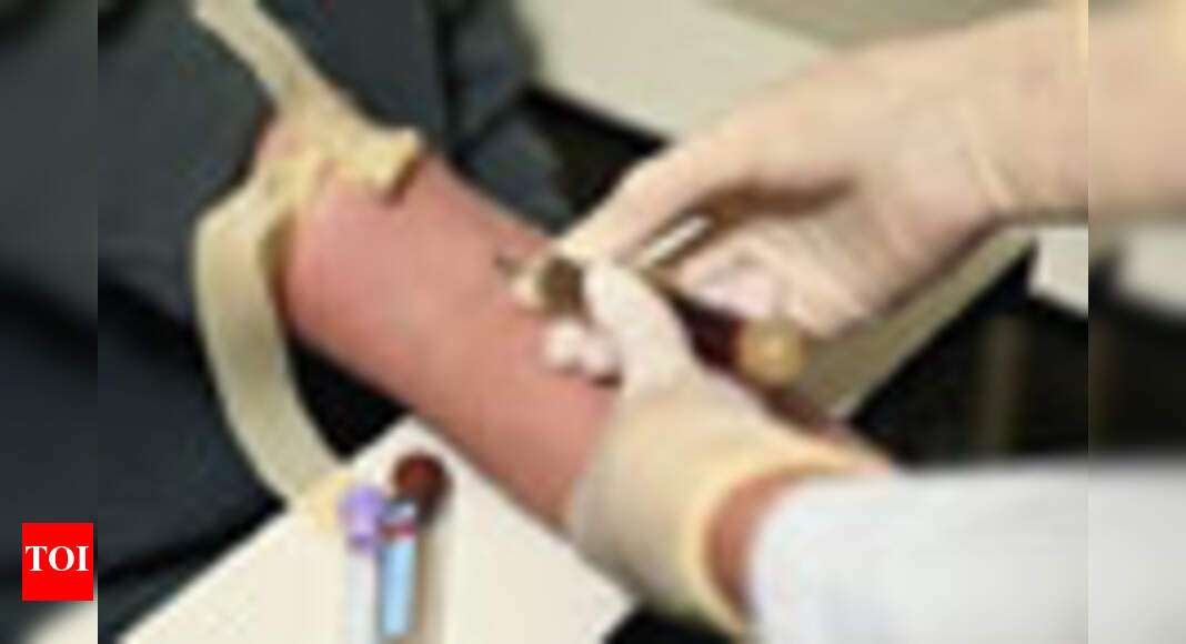 Blood test promise for early Alzheimer's diagnosis - Times of India