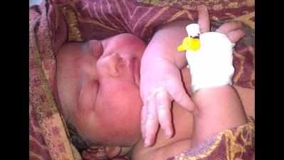 Newborn thrown in dustbin dies of infection