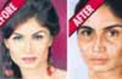 Model's face disfigured at Shilpa Shetty's spa