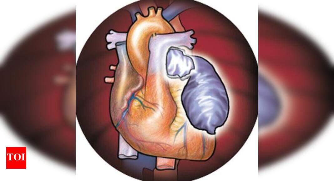 Heart comes for free but transplant cost hits patients | Bengaluru News - Times of India Heart comes for free but transplant cost hits patients | Bengaluru News - Times of India