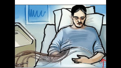 After ten days in coma, 38-year-old man beats failed heart