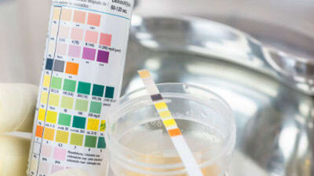 New biomarkers could lead to urine test for preeclampsia The Times of