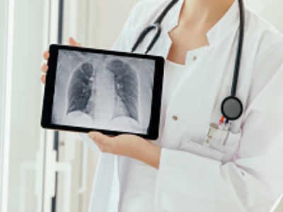 'Bad lifestyle behind 80% of lung cancer cases among old'