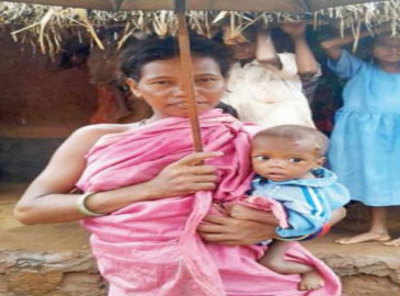 How malnutrition is killing kids of a mineral-rich Odisha tribal village