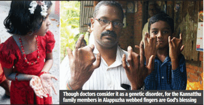 Webbed fingers 'God's gift' for Alappuzha family