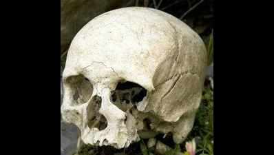 Skull, shin bone discovery scares society residents