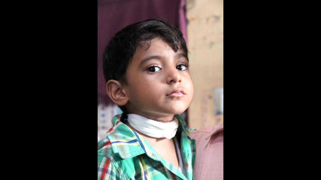 Madhya Pradesh  Madhya Pradesh: Seven-year-old boy dies after kite string  slashes his throat - Telegraph India