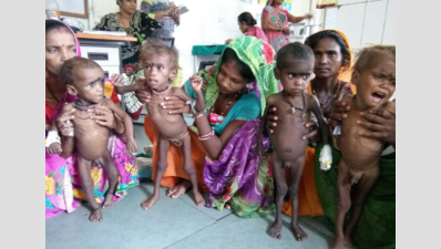 Malnourished child dies in Sheopur; 40 in hospital