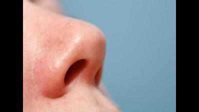Man bites off wife's nose for 'infidelity'