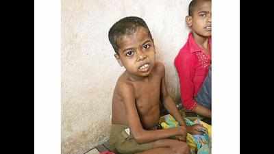 Malnutrition gets govt's attention