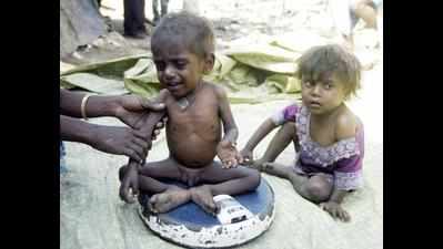 Another malnourished child dies in Sheopur