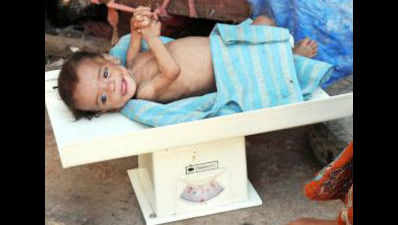 At 4.2kg, malnourished toddler weighs just half of normal children in Palghar