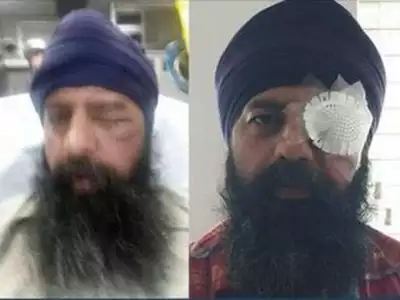 Sikh-American Techie Brutally Assaulted In Alleged Hate Crime In US ...