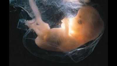 Foetus in ice box at Sawai Man Singh Hospital creates panic