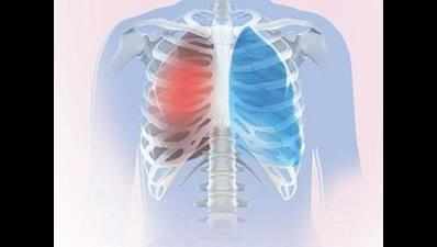Health ministry’s plan to focus on lung disorder
