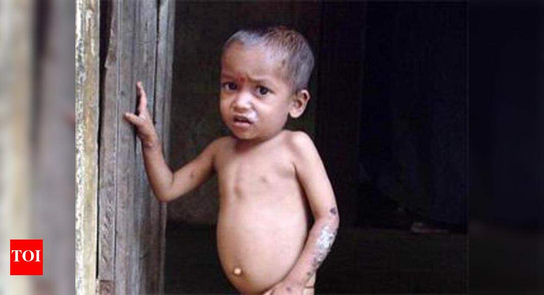 Malnutrition In Kalyan: NGO found seven kids suffering from ...