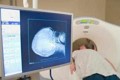 MRI can detect bone marrow cancer: Study - Times of India