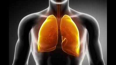 Lung cancer on the rise in non-smokers