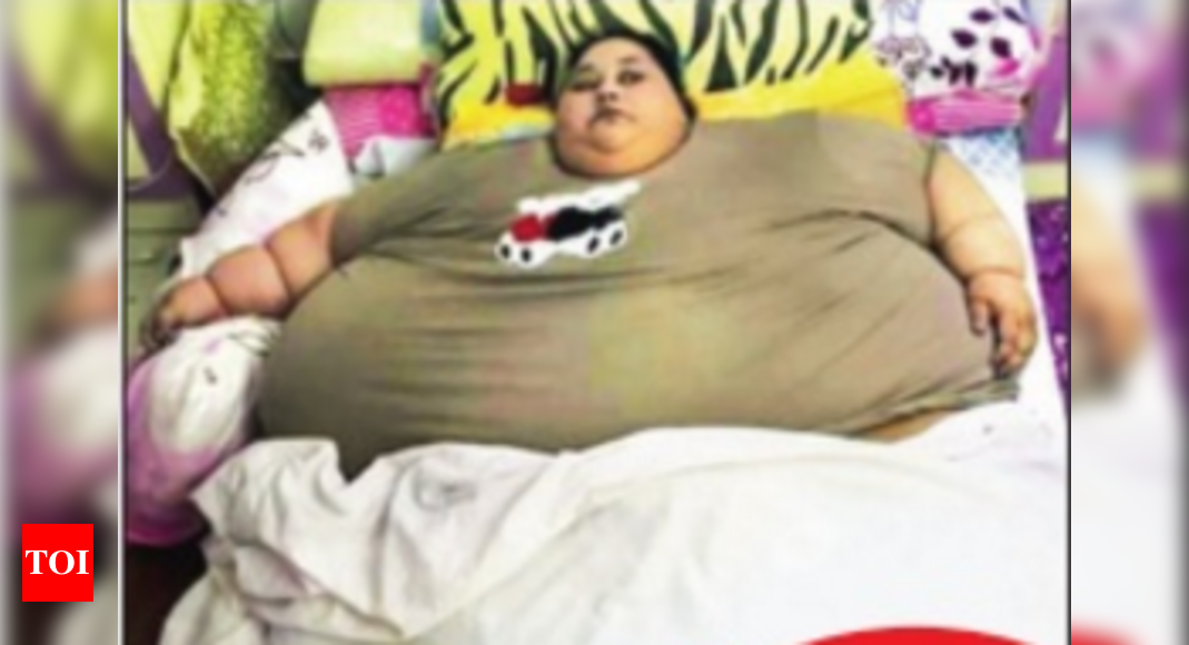 500-kg Egyptian woman will need 2 operations for weight reduction