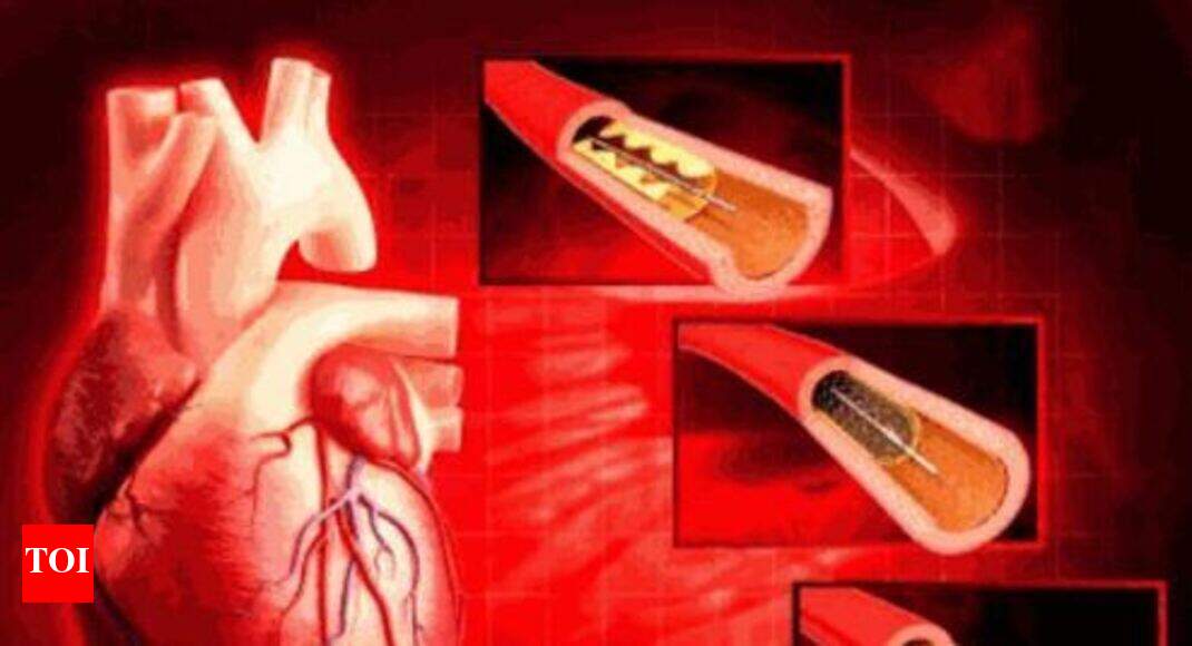 cardiac stents NPPA moves to devise mechanism for capping the prices