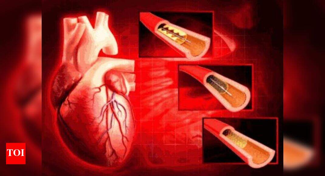 Cardiac Stents NPPA moves to devise mechanism for capping the prices