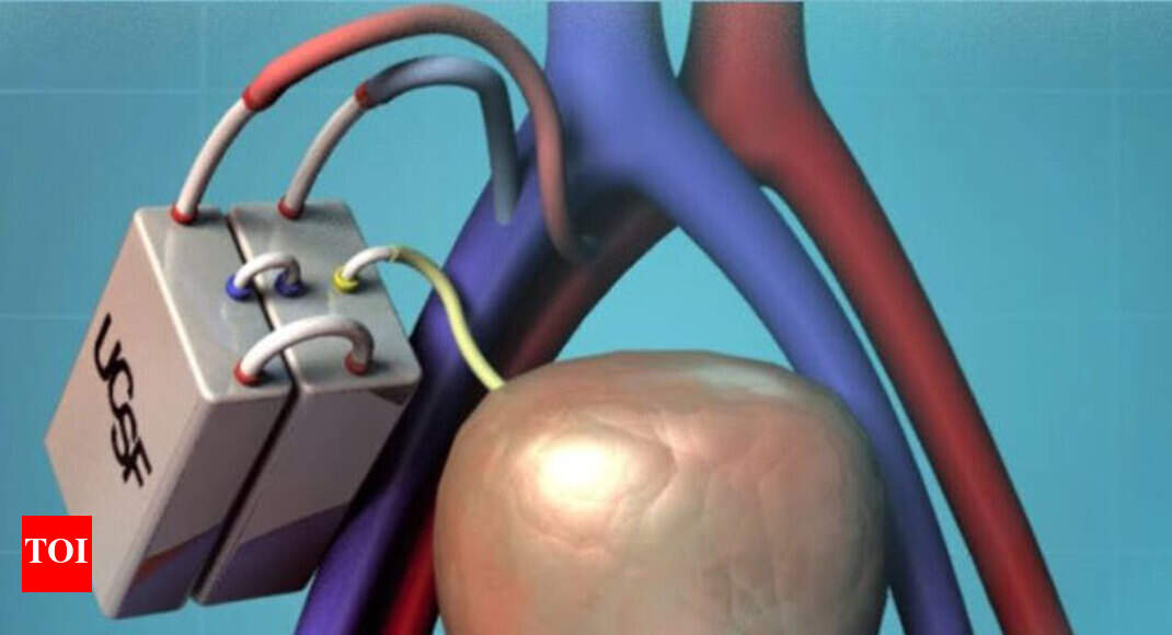 artificial kidney Artificial kidney may hit market by end of decade
